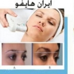 ایران هایفو