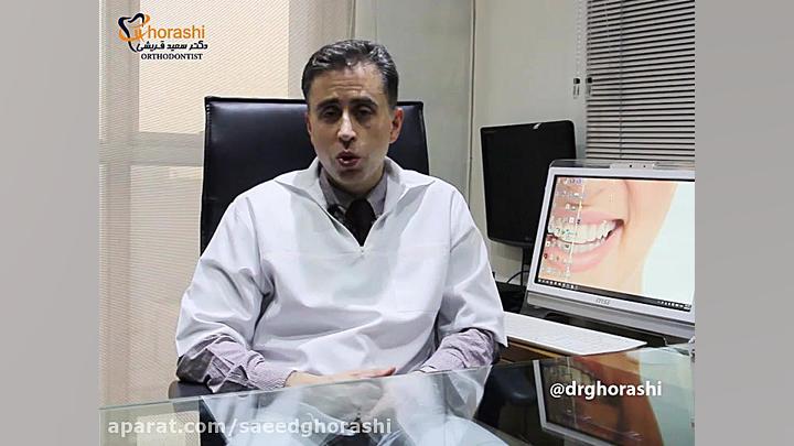 گسترش عرضی فک-دکتر سعید قریشی دکتر سعید قریشی