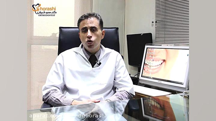 جرم گیری - دکتر سعید قریشی دکتر سعید قریشی