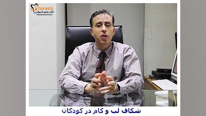 شکاف لب و کام - دکتر سعید قریشی دکتر سعید قریشی