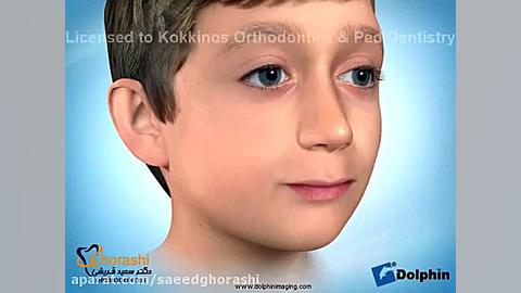 دستگاه فانکشنال فرانکل- دکتر سعید قریشی دکتر سعید قریشی