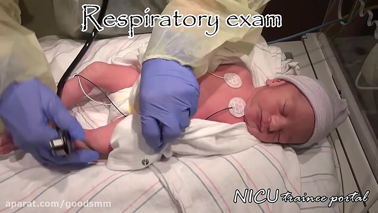 Physical Exam- 35 weeks gestation late preterm infant آهنگ لوطی‌پنگ