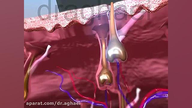 لیزر موهای زائد دکتر حمیده آقایی