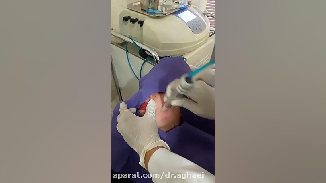 میکرودرم دکتر حمیده آقایی