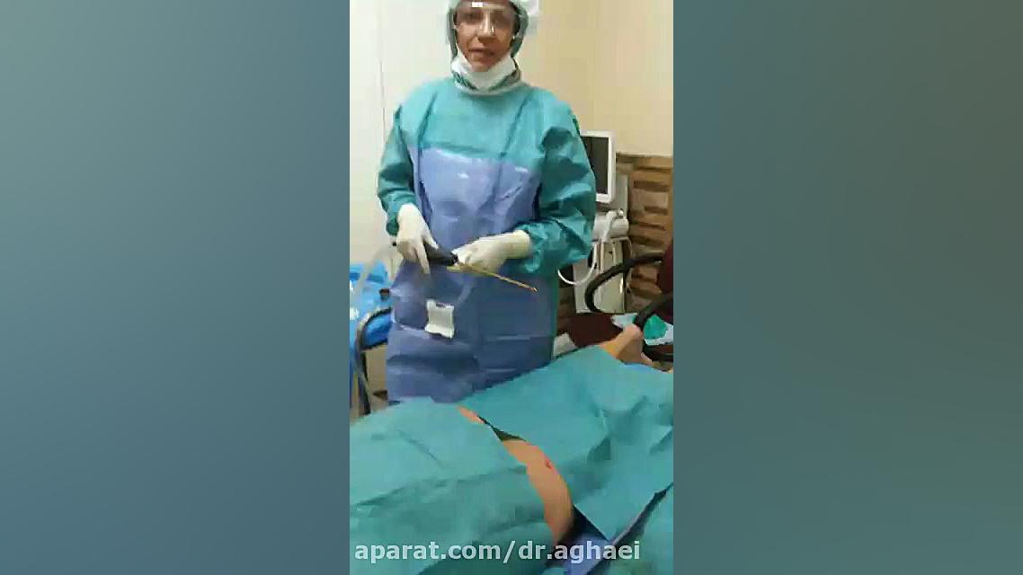 فیلم لیپوماتیک توسط دکتر حمیده آقایی دکتر حمیده آقایی