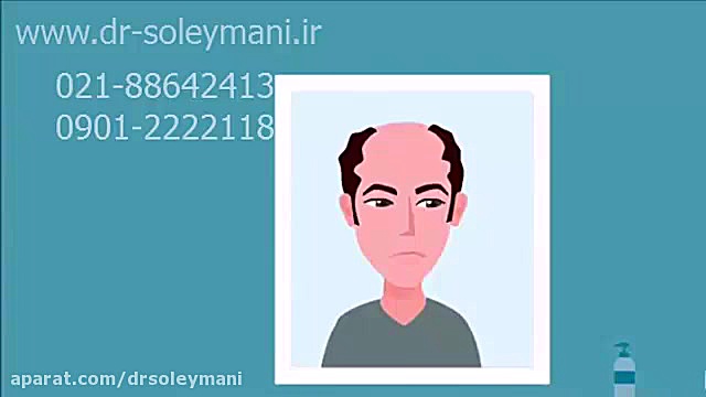 کاشت مو دکتر امیر سلیمانی