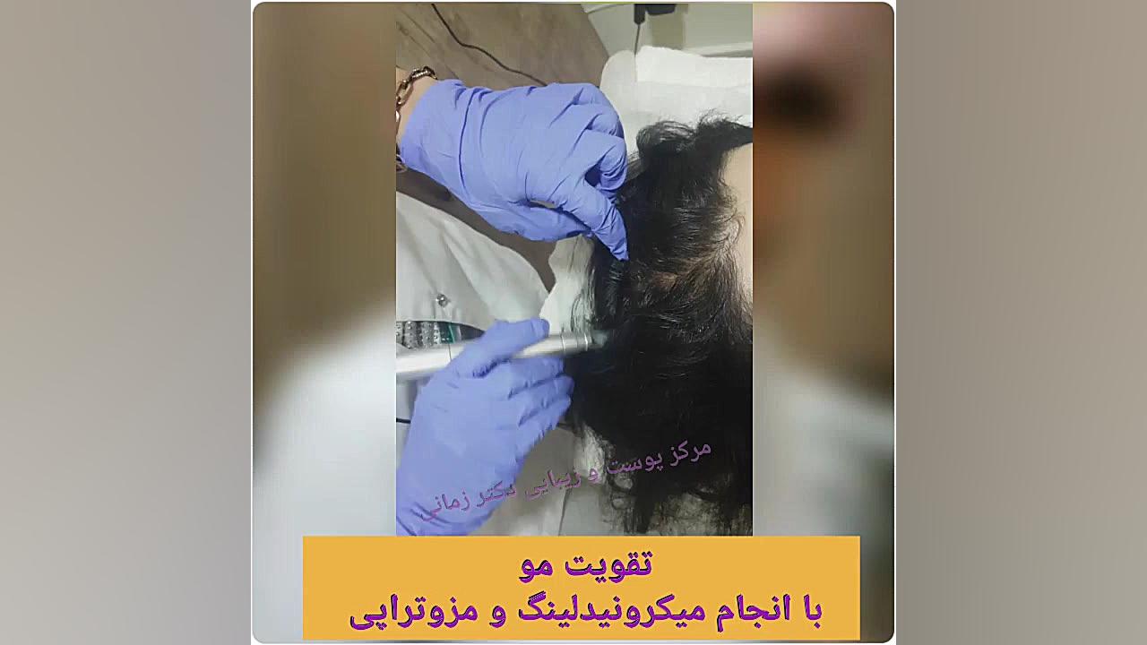 مزوتراپی و میکرونیدلینگ جهت قطع ریزش مو و پرپشت شدن Autophagy Detection Kit