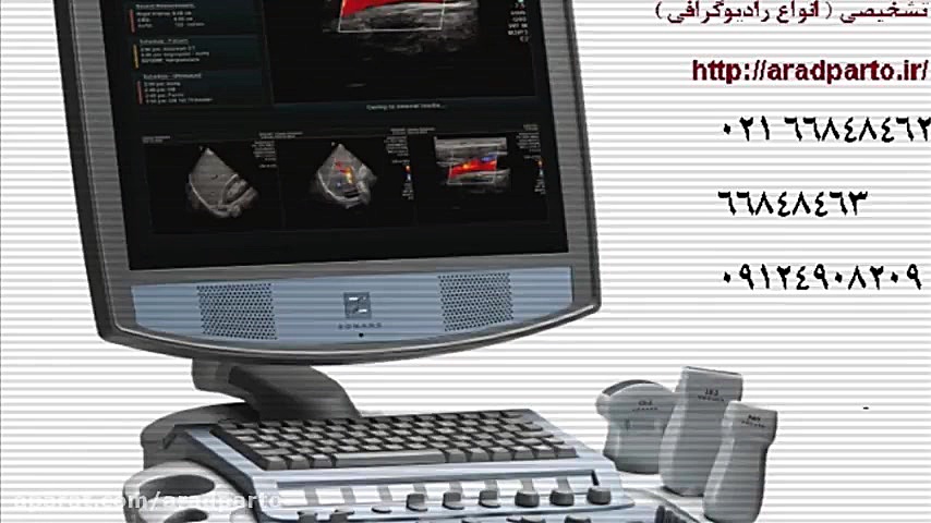 تعمیر سونوگرافی و پراب سونوگرافی پالپوتومی