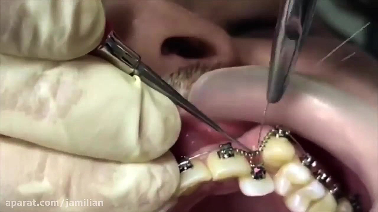 معجره ارتودنسی دکتر عبدالرضا جمیلیان - متخصص ارتودنسی