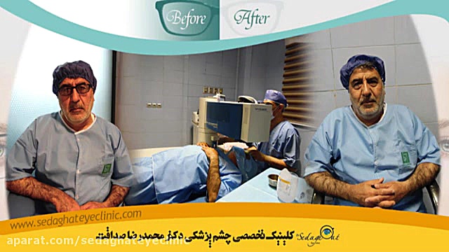 #مقایسه_عملهای_لیزیک (PRK, SMILE ، فمتو لیزیک) دکتر محمدرضا صداقت