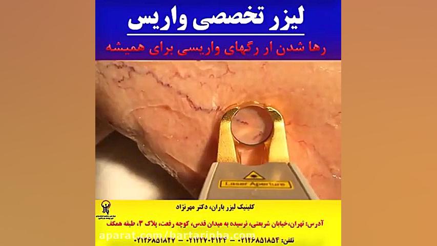 برترین ها - کلینیک پوست و مو باران پیلینگ شیمیایی