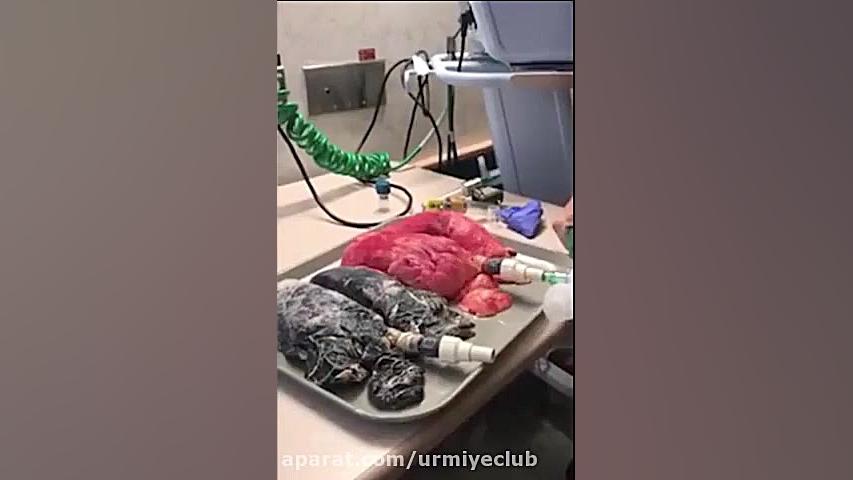 تفاوت ریه یک فرد سالم با یک فرد سیگاری خرگوش اینستاگرامی