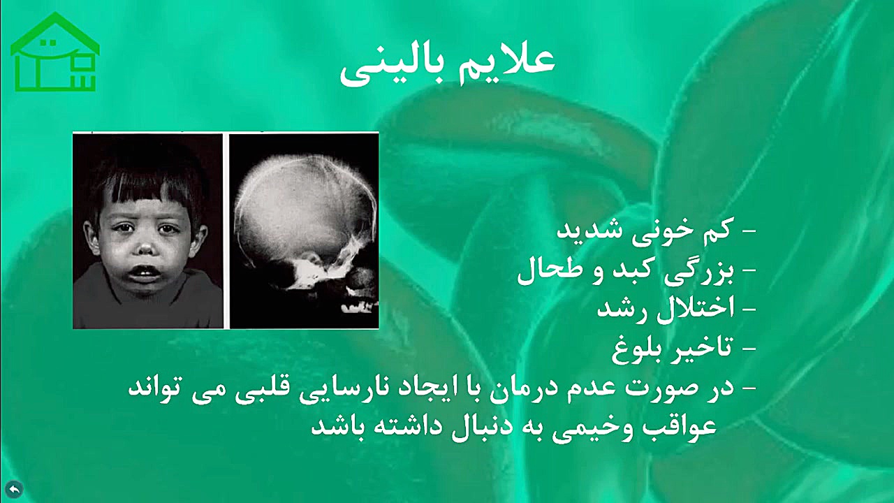 تالاسمی ارنیزوماب