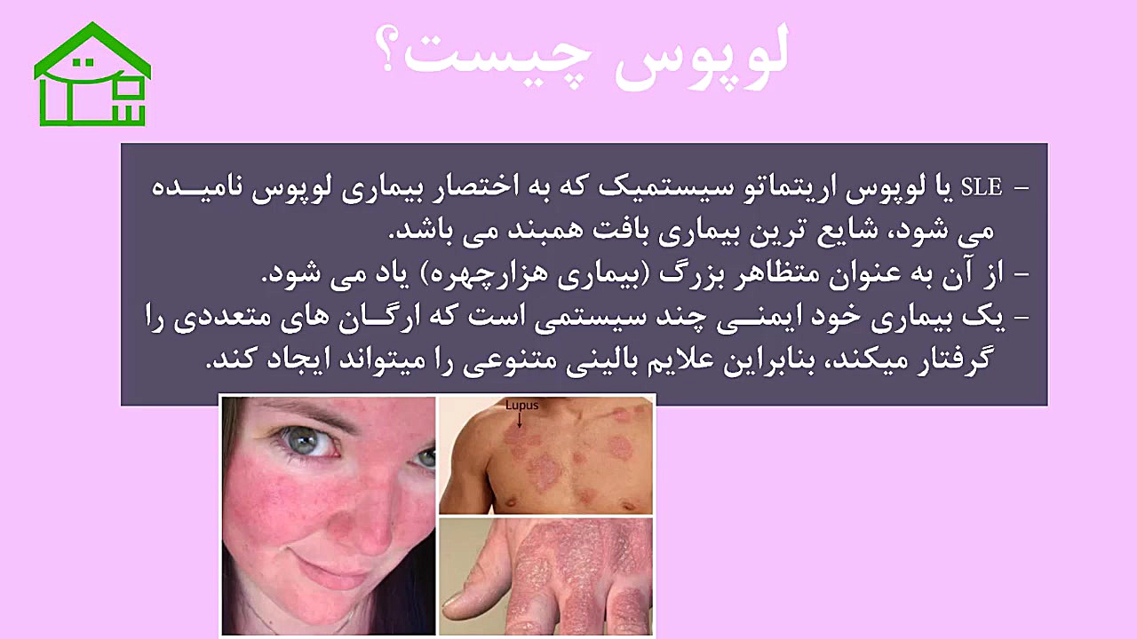 لوپوس کلینیک دندانپزشکی