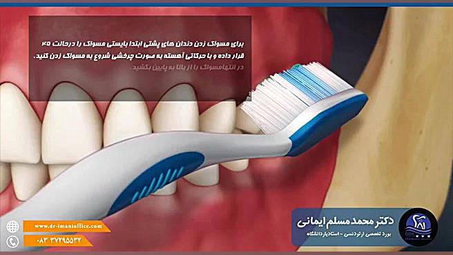 مسواک زدن دندان های پشتی دکتر محمد مسلم ایمانی - متخصص ارتودنسی در کرمانشاه