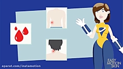 کاربردهای ورزش EMS در تناسب ان...