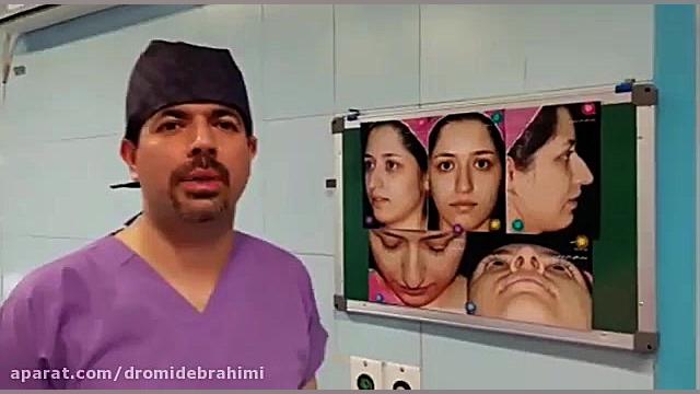 نمونه کار بهترین جراح بینی تهران، دکتر امید ابراهیمی دکتر امید ابراهیمی