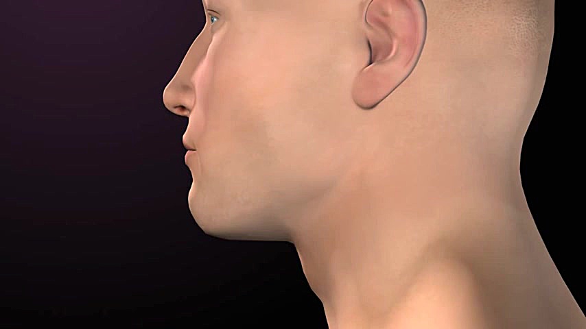 حنجره کلیپ ضدحال