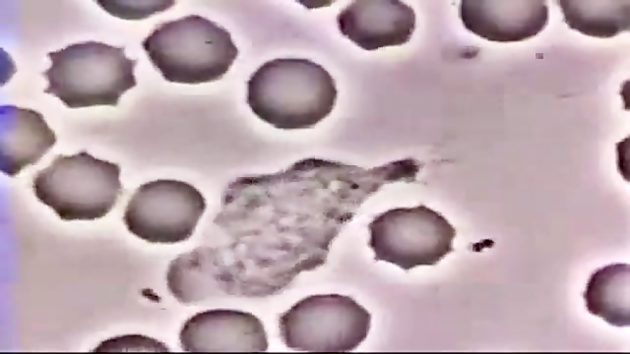 نبرد گلبول سفید با باکتری Single Molecule Real Time Sequencing