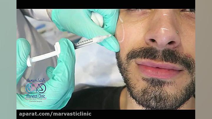 تزریق بوتاکس به گونه و بینی جراحی بینی
