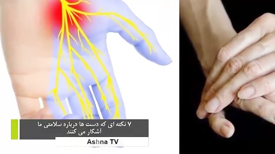 از کف دست بفهمید چه مریضی دارید؟ Top 10 farsi