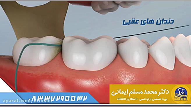 نحوه صحیح کشیدن نخ دندان دکتر محمد مسلم ایمانی - متخصص ارتودنسی در کرمانشاه