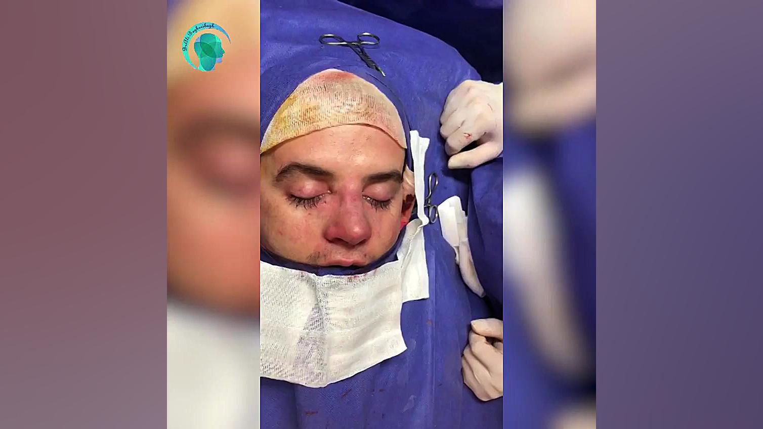 نمونه جراحی زیبایی بینی دکتر علی باقری حق