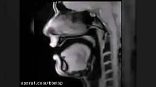 تصویر برداری ام آر آی(MRI) از انسان هنگام صحبت کردن مریل استریپ