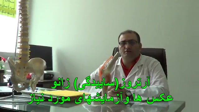 عکس ها وآزمایش های لازم در درد زانو -دکتردقاق زاده-طب فیزیکی لیفت پیشانی