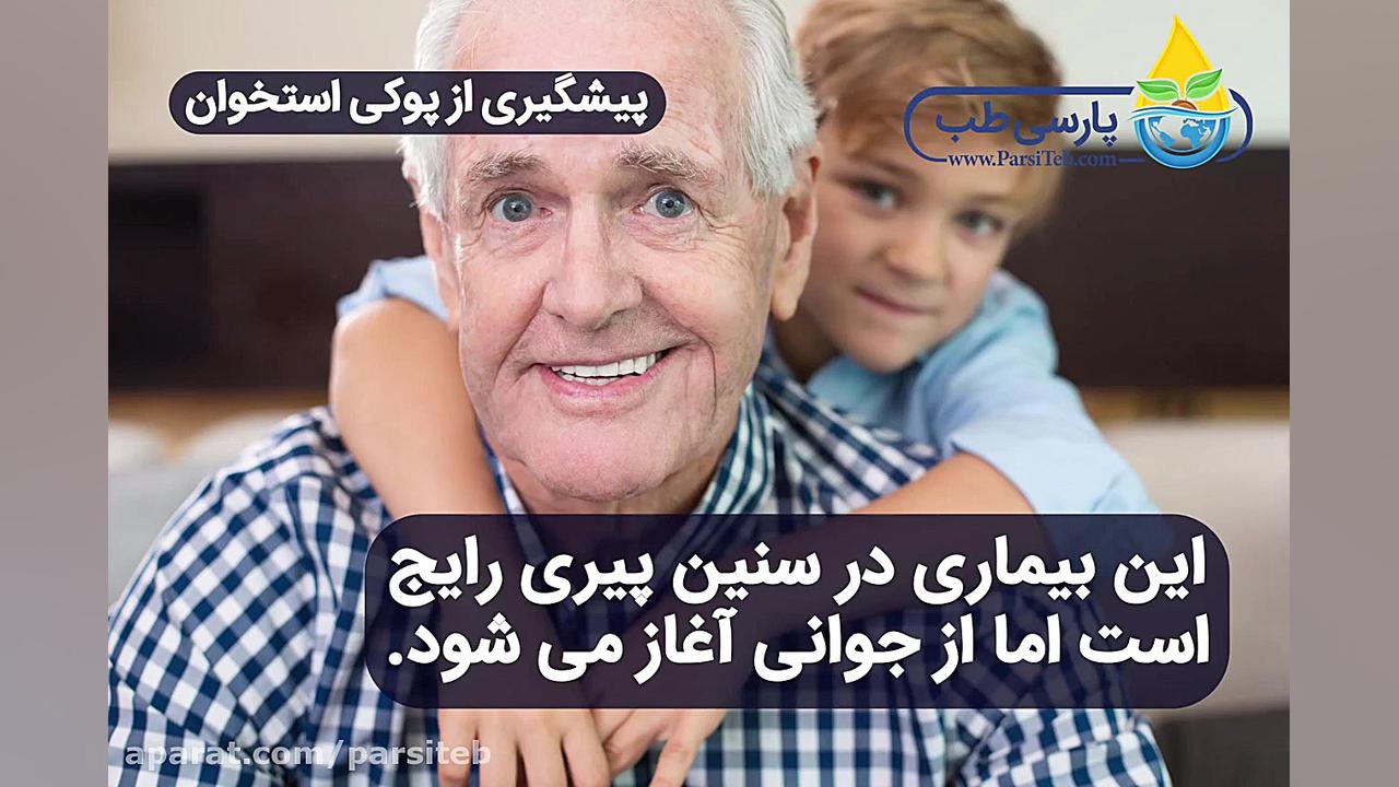 پیشگیری از پوکی استخوان با معجون جادویی | پارسی طب دندانپزشکی کودکان