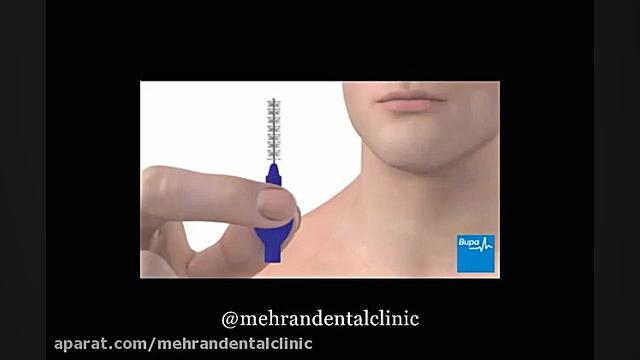 نخ دندان | mehrandentalclinic.ir کلینیک تخصصی دندانپزشکی مهران