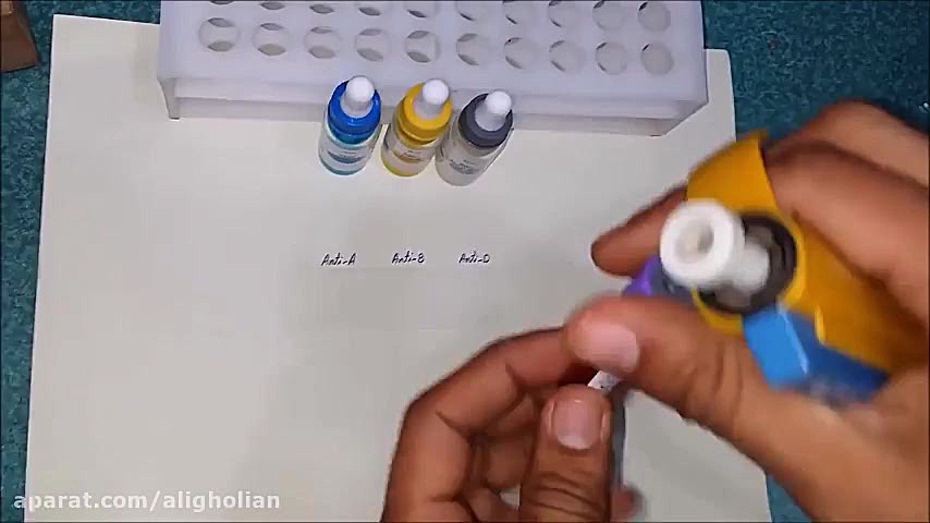 تعیین گروه خونی در آزمایشگاه لیزر فرکشنال