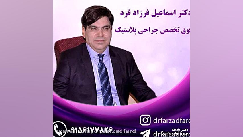 بخشی از نمونه جراحی های دکتر اسماعیل فرزاد فرد دکتر اسماعیل فرزاد فرد - فوق تخصص پلاستیک