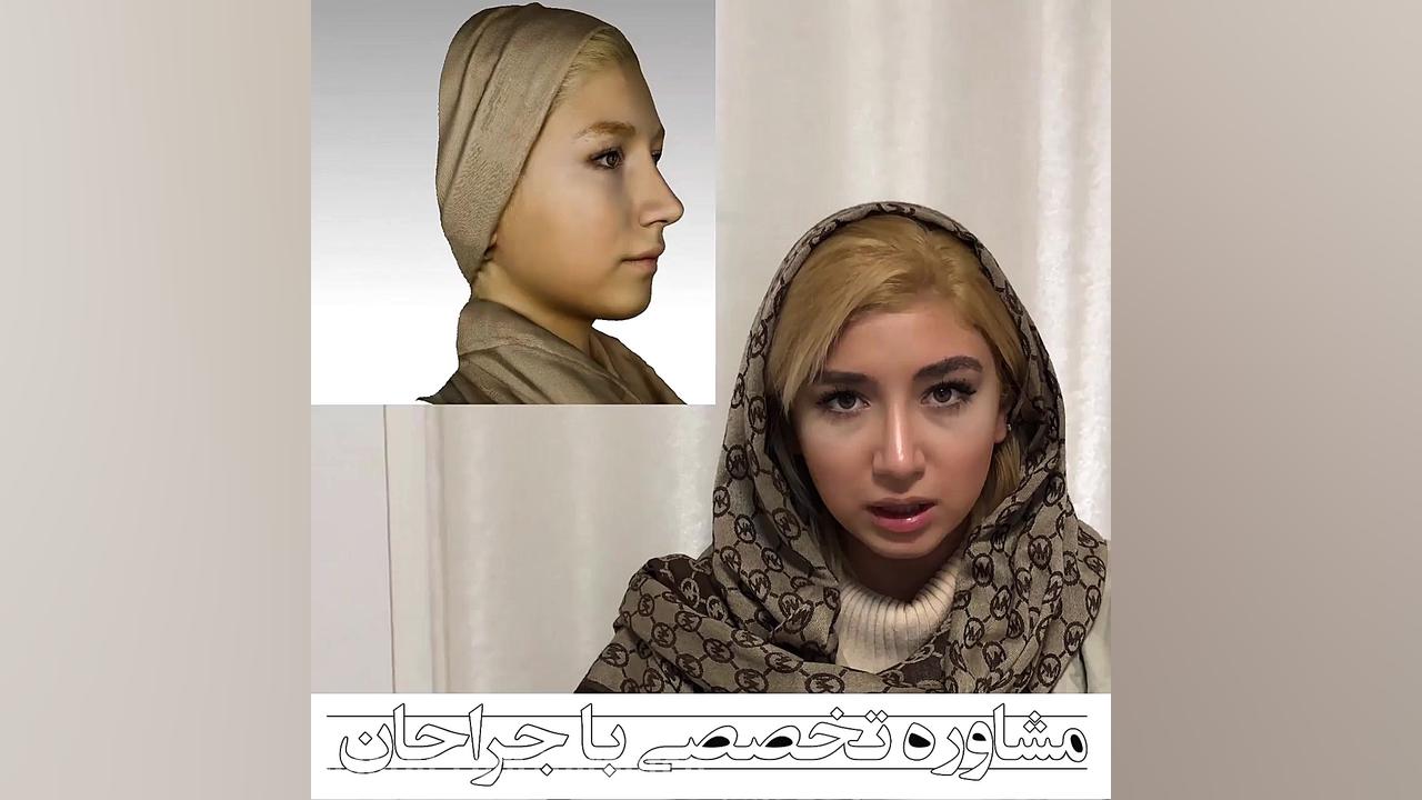 بهترین جراحی بینی فشن شو