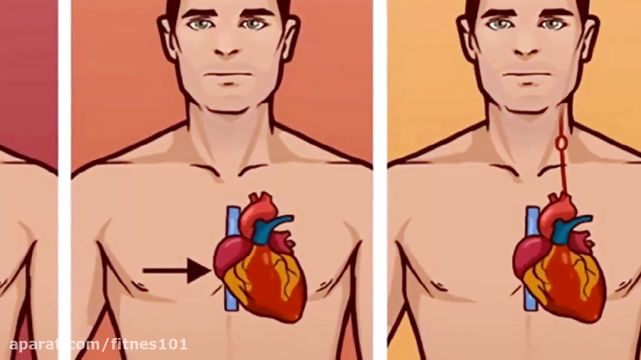 You Must Know The Differences Between A Heart Attack Cardiac Arrest