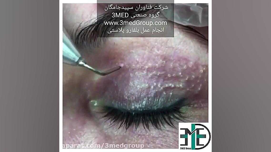 پلاسما فن آوران سپیدجامگان HIDA Scan