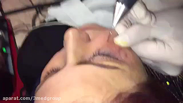 پلاسما فن آوران سپیدجامگان رادیوگرافی دندان