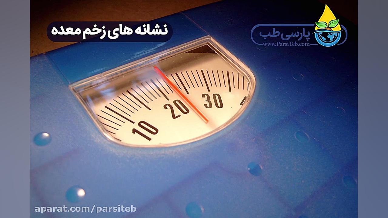 آیا می دانید نشانه های زخم معده چیست؟ | پارسی طب عمل زیبایی
