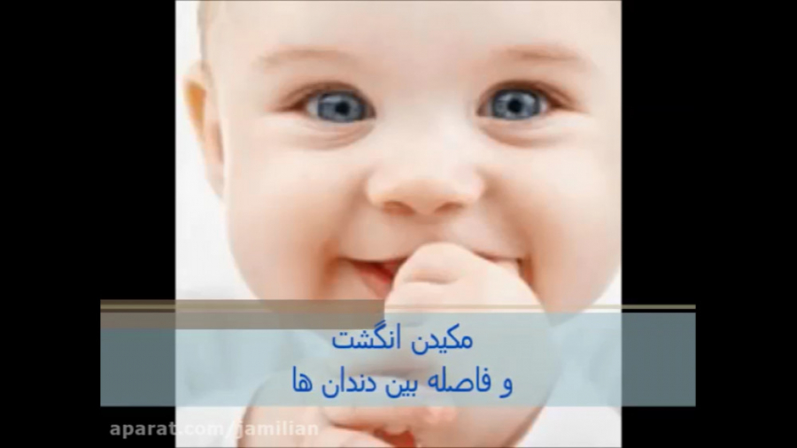 مکیدن انگشت و خطر فاصله افتادن بین دندان ها دکتر عبدالرضا جمیلیان - متخصص ارتودنسی