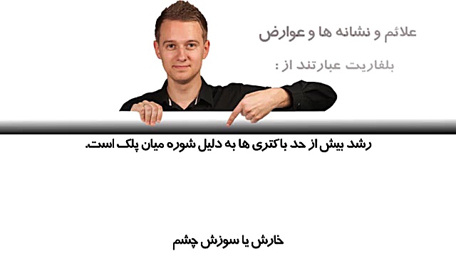 #بلفاریت_و_درمان_آن دکتر محمدرضا صداقت