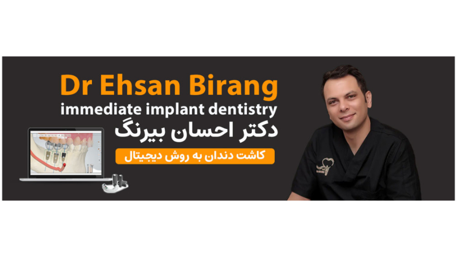تفاوت دندان طبیعی با ایمپلنت | دکتر احسان بیرنگ متخصص ایمپلنت در تهران دکتر احسان بیرنگ