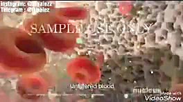 آشنایی با کارکرد کلیه های انسان و دیالیز روشی جایگزین اینسایزینگ
