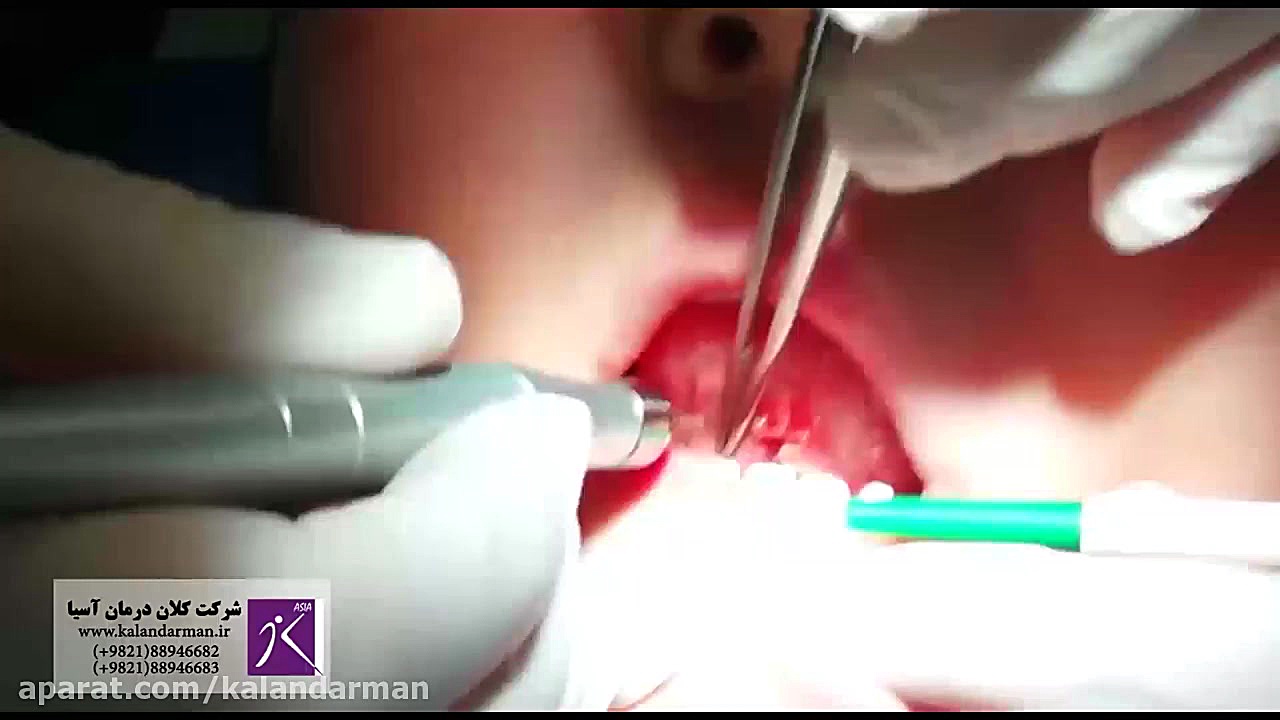 لیزر دندانپزشکی- هتدپیس از جنس یاقوت پلتفرم Drug Screening