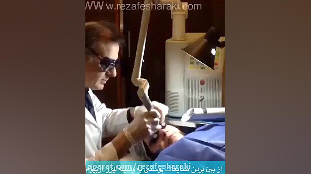 از بین بردن ضایعات پوستی به وسیله لیزر اربیوم دکتر رضا جعفری فشارکی- متخصص پوست و مو