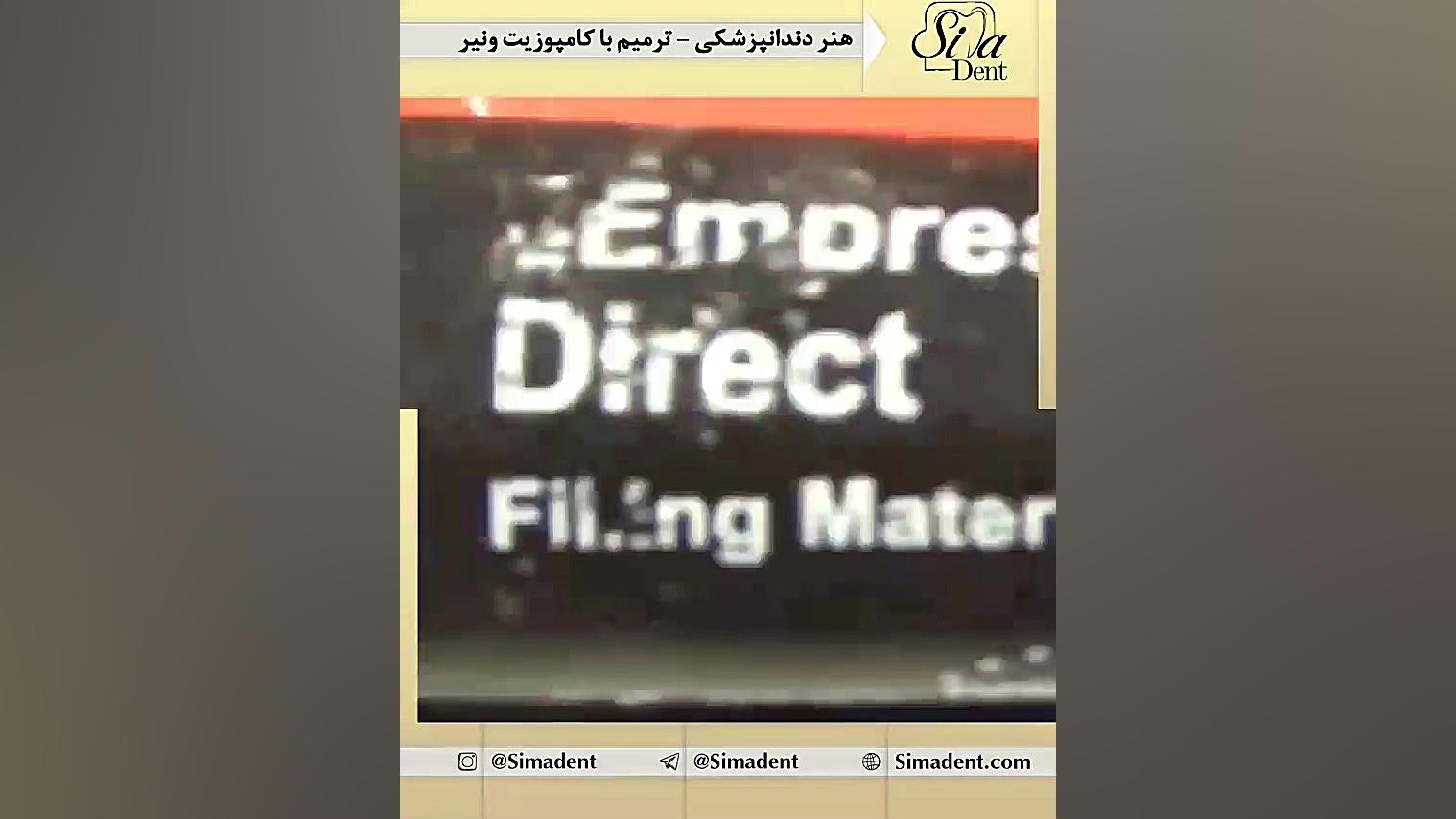 ترمیم دندان با کامپوزیت ونیر | دندانپزشکی سیمادنت بیماری نوری آسیب ارثی