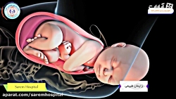 آنچه باید از زایمان طبیعی بدان...