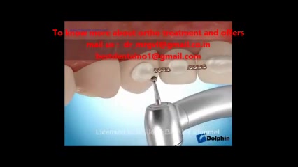 ارتودنسی لینگوال دکتر سهیل سالاری