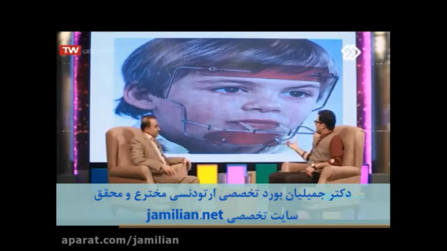 جدیدترین درمان ناهنجاری فک بالا دکتر عبدالرضا جمیلیان - متخصص ارتودنسی