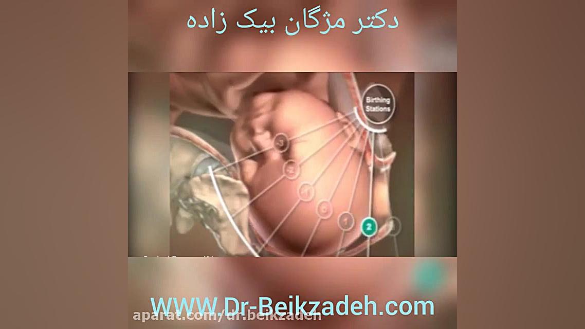 انعطاف بدن در هنگام زایمان طبیعی - دکتر مژگان بیک زاده دکتر مژگان بیک زاده ( جراح و متخصص زنان و زایمان)