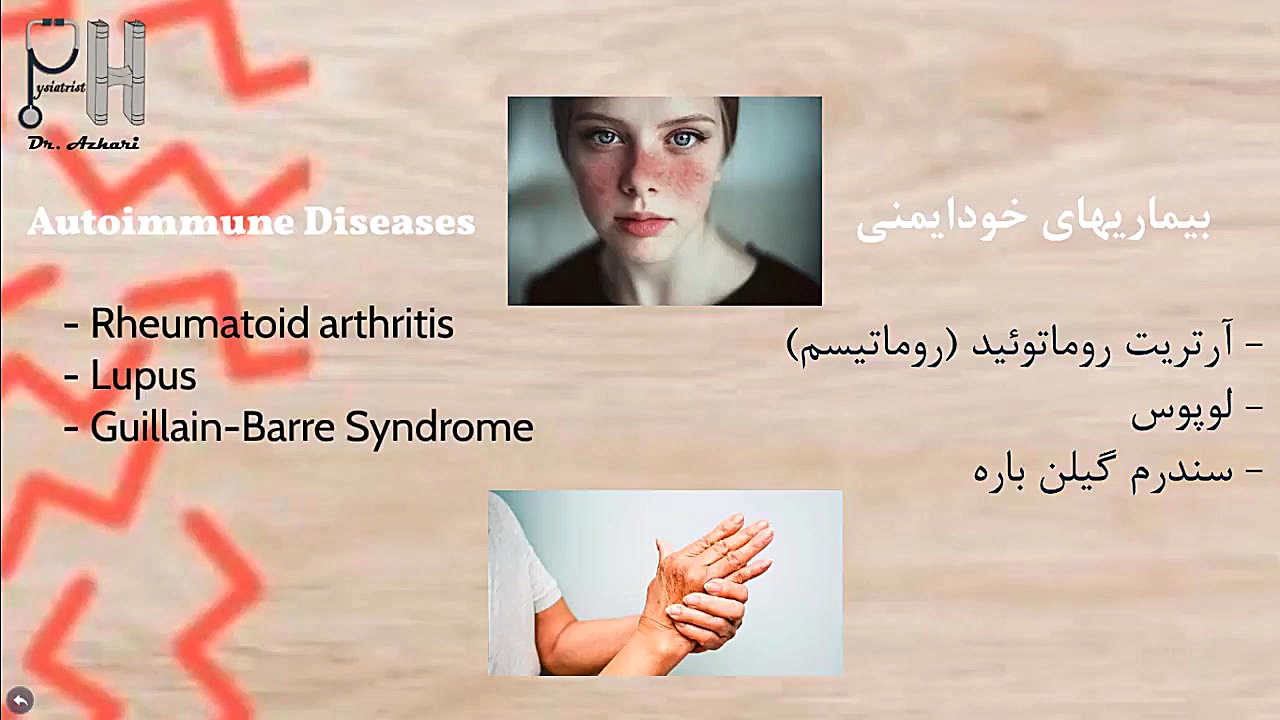علل گزگز، مورمور و خواب رفتگی دست و پا - Paresthesia حلزون تیک‌تاکی